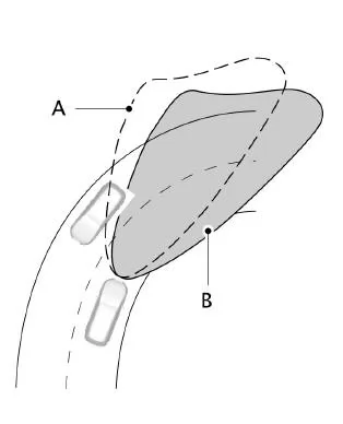 Adaptives Scheinwerfersystem